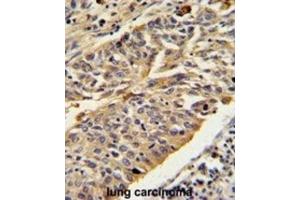 Immunohistochemistry (IHC) image for anti-Cathepsin E (CTSE) antibody (ABIN3002688) (Cathepsin E anticorps)