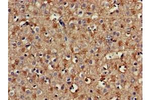 Immunohistochemistry of paraffin-embedded human brain tissue using ABIN7142041 at dilution of 1:100 (Phospholipase C beta 1 anticorps  (AA 781-896))