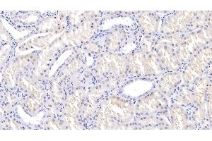 Detection of TGFb3 in Human Kidney Tissue using Polyclonal Antibody to Transforming Growth Factor Beta 3 (TGFb3) (TGFB3 anticorps  (AA 274-372))