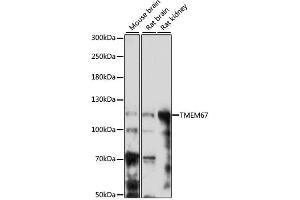 Western blot analysis of extracts of various cell lines, using TMEM67 antibody (ABIN6293383) at 1:1000 dilution. (TMEM67 anticorps)
