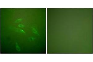 Immunofluorescence analysis of HeLa cells, using Collagen III Antibody.