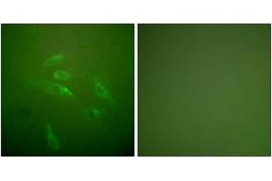 Immunofluorescence analysis of HeLa cells, using Collagen III Antibody. (COL3 anticorps  (AA 81-130))