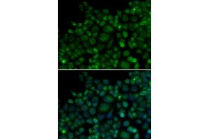 Immunofluorescence analysis of MCF-7 cells using TLR7 antibody. (TLR7 anticorps)