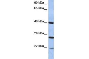 WB Suggested Anti-CIDEB Antibody Titration:  0. (CIDEB anticorps  (Middle Region))