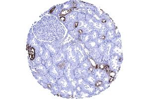 Kidney cortex A strong cytoplasmic Calbindin 1 immunostaining occurs in a fraction of distal tubuli of the kidney