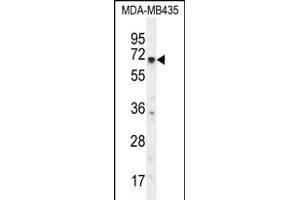 KCNQ1 Antibody (N-term) (ABIN656077 and ABIN2845424) western blot analysis in MDA-M cell line lysates (35 μg/lane). (KCNQ1 anticorps  (N-Term))