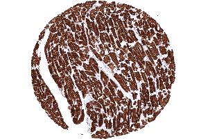 Heart muscle showing a strong cytoplasmic MYH7 staining of all cells