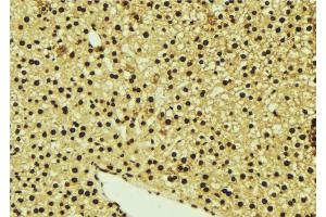 ABIN6277078 at 1/100 staining Mouse liver tissue by IHC-P.