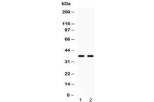 Western blot testing of human 1) HeLa and 2) A549 cell lysate with Annexin VIII antibody at 0. (Annexin VIII anticorps  (AA 20-61))