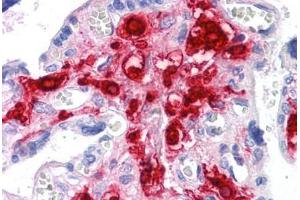 Human Placenta: Formalin-Fixed, Paraffin-Embedded (FFPE)