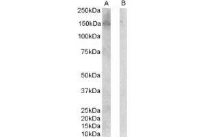 Image no. 1 for anti-Receptor Tyrosine-Protein Kinase ErbB-3 (ERBB3) (C-Term), (Isoform 1) antibody (ABIN374599) (ERBB3 anticorps  (C-Term, Isoform 1))