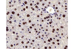 Immunohistochemistry analysis of paraffin-embedded mouse liver using c-Fos Polyclonal Antibody at dilution of 1:200. (c-FOS anticorps)