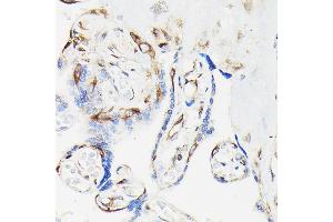 Immunohistochemistry of paraffin-embedded human placenta using Phospho-VASP-S239 Rabbit pAb (ABIN3019748, ABIN3019749, ABIN3019750, ABIN1682137 and ABIN1682138) at dilution of 1:50 (40x lens).