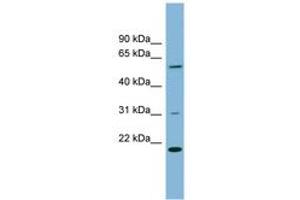 Image no. 1 for anti-TP53RK Binding Protein (TPRKB) (AA 35-84) antibody (ABIN6742046) (TPRKB anticorps  (AA 35-84))