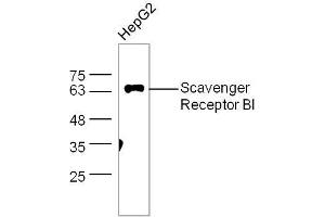 HepG2 lysates probed with Scavenger receptor class B member 1 Polyclonal Antibody, unconjugated  at 1:300 overnight at 4°C followed by a conjugated secondary antibody at 1:10000 for 60 minutes at 37°C. (SCARB1 anticorps  (AA 21-100))