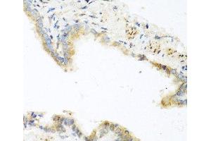 Immunohistochemistry of paraffin-embedded Mouse lung using RETN Polyclonal Antibody at dilution of 1:100 (40x lens). (Resistin anticorps)