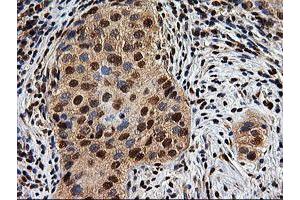 Image no. 7 for anti-EPM2A (Laforin) Interacting Protein 1 (EPM2AIP1) antibody (ABIN1498046) (EPM2AIP1 anticorps)