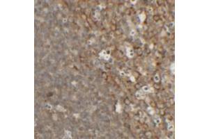 Immunohistochemical analysis of TFCP2L1 in rat colon tissue with TFCP2L1 polyclonal antibody  at 2. (TFCP2L1 anticorps  (N-Term))