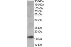 Western Blotting (WB) image for anti-Ubiquitin-Conjugating Enzyme E2I (UBE2I) (N-Term) antibody (ABIN2465320) (UBE2I anticorps  (N-Term))