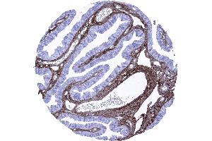 Fallopian tube mucosa Strong decorin immunostaining in the stroma while staining is completely lacking in epithelial cells decorin immunohistochemistry