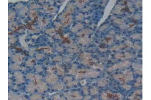 IHC-P analysis of Rat Pancreas Tissue, with DAB staining. (TNFRSF11A anticorps  (AA 31-214))