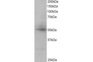 Western Blotting (WB) image for anti-CAMP Responsive Element Binding Protein 3-Like 4 (CREB3L4) (C-Term) antibody (ABIN2465555) (CREB3L4 anticorps  (C-Term))