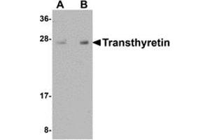 Western Blotting (WB) image for anti-Transthyretin (TTR) (Middle Region) antibody (ABIN1031141) (TTR anticorps  (Middle Region))