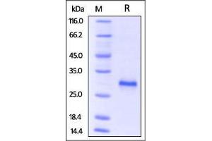 Mouse CD40, His Tag on SDS-PAGE under reducing (R) condition.