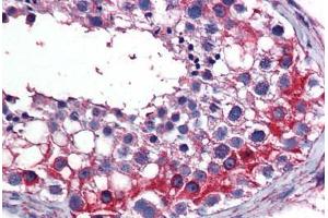 Human Testis: Formalin-Fixed, Paraffin-Embedded (FFPE) (TES anticorps  (AA 1-422))