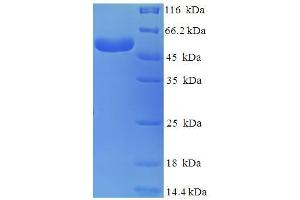 SDS-PAGE (SDS) image for Branched Chain Amino-Acid Transaminase 2, Mitochondrial (BCAT2) (AA 28-392) protein (His-SUMO Tag) (ABIN5709119)