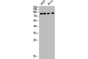 Western Blot analysis of various cells using Antibody diluted at 1:1000. (IL4 Receptor anticorps  (Internal Region))