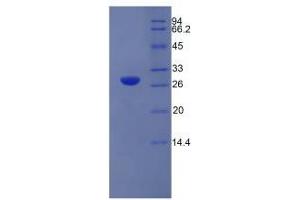 SDS-PAGE analysis of Rat Elastase 3B Protein.