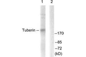 Western blot analysis of extracts from 293 cells, treated with Anisomycin 25ug/ml 30', using Tuberin/TSC2 (Ab-939) Antibody. (Tuberin anticorps  (AA 905-954))