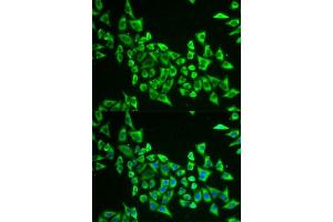 Immunofluorescence analysis of U2OS cells using MRPS30 antibody. (MRPS30 anticorps  (AA 190-439))
