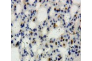 Used in DAB staining on fromalin fixed paraffin-embedded Lung tissue (Lipocalin 2 anticorps  (AA 21-200))
