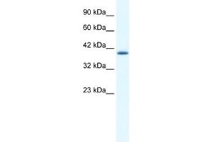 WB Suggested Antibody  Titration: 0. (ZNF365 anticorps  (N-Term))