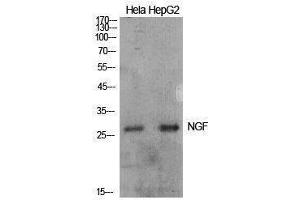 Western Blotting (WB) image for anti-Nerve Growth Factor (NGF) (Internal Region) antibody (ABIN3181419) (Nerve Growth Factor anticorps  (Internal Region))