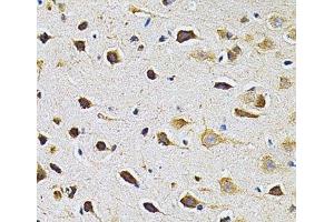 Immunohistochemistry of paraffin-embedded Rat brain using ADRBK1 Polyclonal Antibody at dilution of 1:200 (40x lens). (GRK2 anticorps)