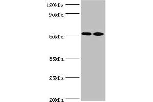 Western blot All lanes: Annexin A7 antibody at 4 μg/mL Lane 1: Jurkat whole cell lysate Lane 2: LO2 whole cell lysate Secondary Goat polyclonal to rabbit at 1/10000 dilution Predicted band size: 53, 51 kDa Observed band size: 53 kDa