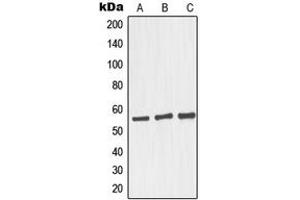 Western blot analysis of GRASP55 expression in HepG2 (A), Raji (B), LOVO (C) whole cell lysates. (GORASP2 anticorps  (Center))