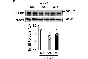 Adipocyte TonEBP expression is elevated in obesity and TonEBP-deficient mice resist obesity.