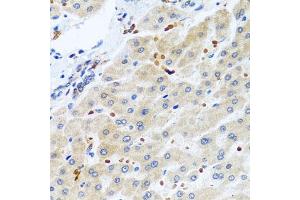 Immunohistochemistry of paraffin-embedded human liver using RGS5 antibody (ABIN6130676, ABIN6146924, ABIN6146925 and ABIN6222790) at dilution of 1:100 (40x lens). (RGS5 anticorps  (AA 1-181))