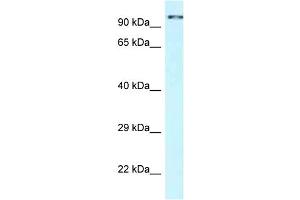 WB Suggested Anti-CDK11A Antibody Titration: 1.