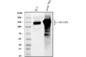 Western blot analysis of AKAP2 using anti-AKAP2 antibody (ABIN5518729).