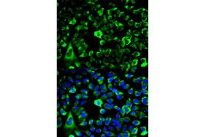 Immunofluorescence analysis of HeLa cells using RPS3 antibody (ABIN6290898). (RPS3 anticorps)