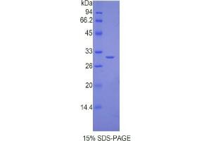 SDS-PAGE analysis of Mouse IL17RC Protein. (IL17RC Protéine)