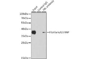 Immunoprecipitation analysis of 200 μg extracts of HeLa cells using 1 μg Fibrillarin/U3 RNP antibody .