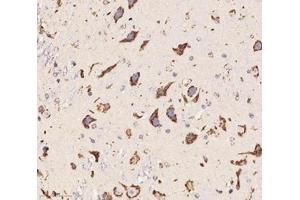 Immunohistochemistry analysis of paraffin-embedded mouse cerebellum using,Chrnb1 (ABIN7074841) at dilution of 1: 2000 (CHRNB1 anticorps)