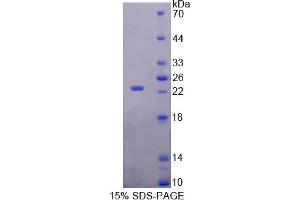 SDS-PAGE analysis of Rat RBP5 Protein.