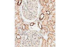 Immunohistochemical analysis of paraffin-embedded human kidney tissue using D performed on the Leica® BOND RXm. (GLS2 anticorps  (AA 498-524))